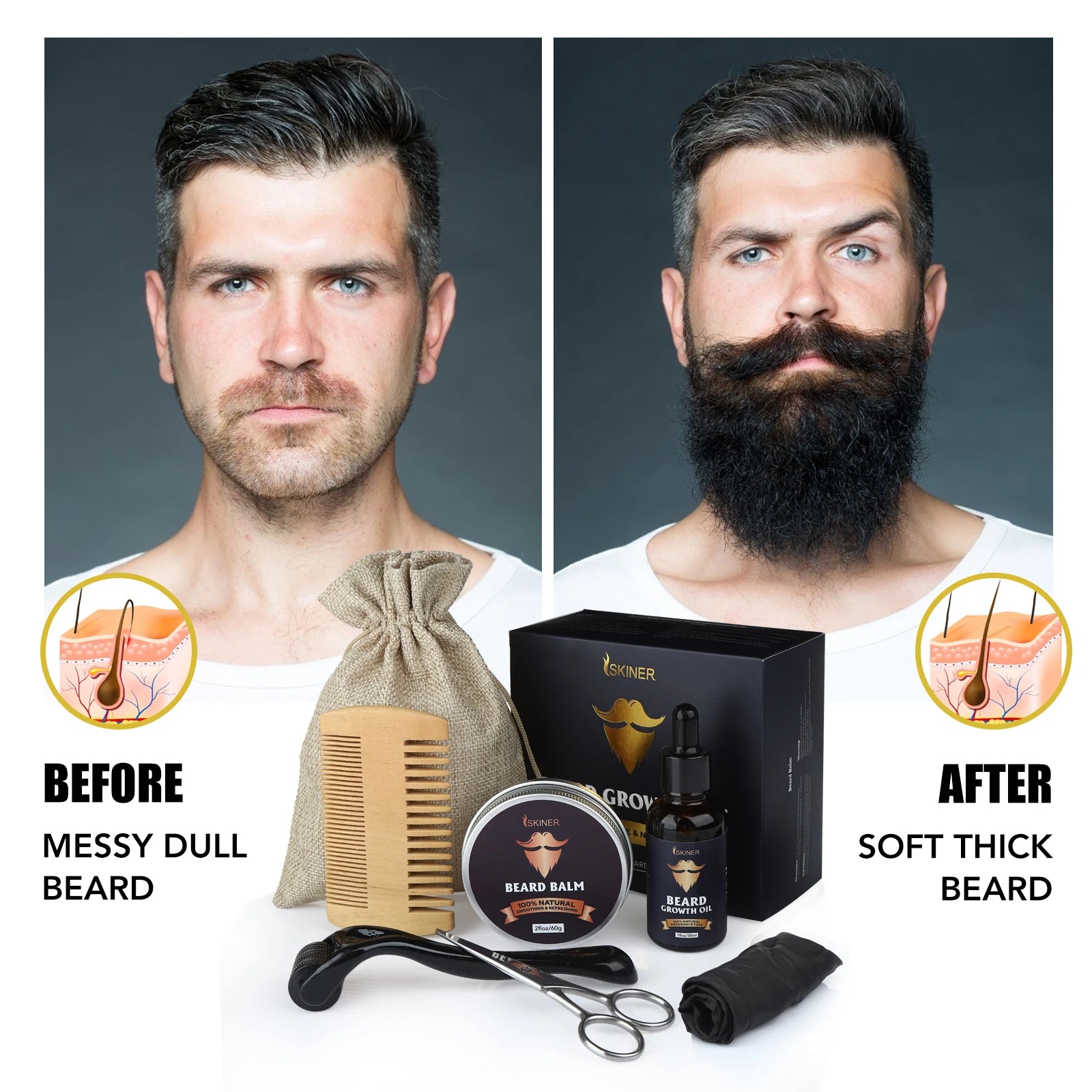 Beard Growth Kit – 5 Piece Set